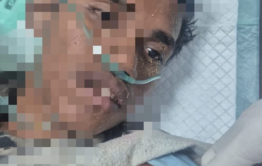 Seorang Pelajar Dikeroyok OTK di SP 1 Mimika, Alami Luka Tikam Ditusuk Kanan