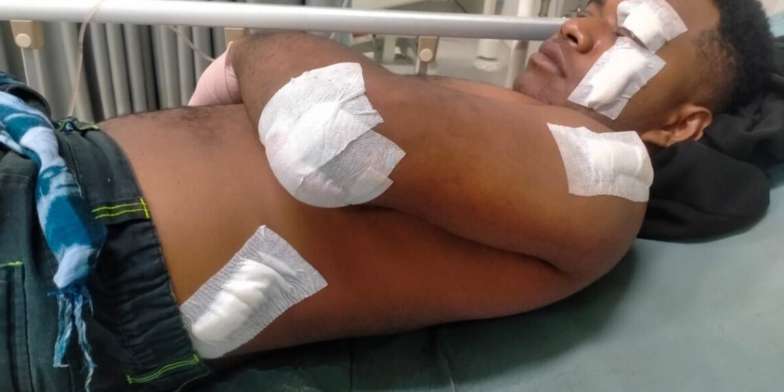 Pria Muda Dianiaya Dengan Senjata Tajam Oleh Orang Mabuk di Kompleks Gorong gorong Mimika