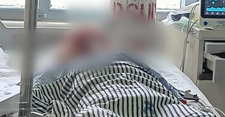 Seorang Pemuda Tewas Setelah Dipukul Pakai Palu di Kuala Kencana Mimika