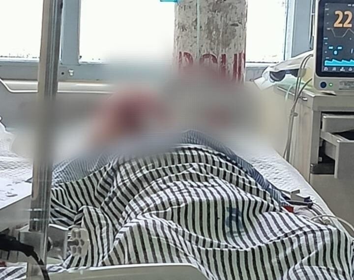 Seorang Pemuda Tewas Setelah Dipukul Pakai Palu di Kuala Kencana Mimika