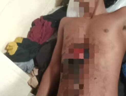 Tiga ABK Kapal Nelayan Dari Jawa Ditikam Temannya Sendiri Saat Pesta Miras di Atas Kapal Saat Tiba di Timika