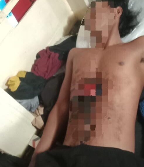 Tiga ABK Kapal Nelayan Dari Jawa Ditikam Temannya Sendiri Saat Pesta Miras di Atas Kapal Saat Tiba di Timika