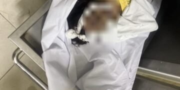 Seorang Wanita di Mimika Ditemukan Tewas Gantung Diri oleh Suaminya, Tapi Polisi Tidak Ditemukan Tanda-tanda Bekas di Leher