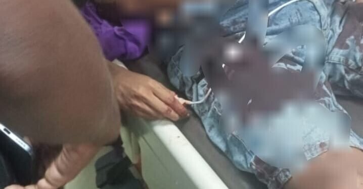 Kecelakaan Lalu Lintas di Jalan Yos Sudarso Mimika Dua Orang Mengalami Luka