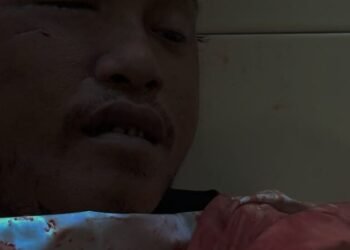 Pria tak Bernyawa Ditemukan Warga di Jalan Irigasi Ujung Timika, Luka Sobek Menganga di Pelipis Kanan