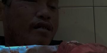 Pria tak Bernyawa Ditemukan Warga di Jalan Irigasi Ujung Timika, Luka Sobek Menganga di Pelipis Kanan