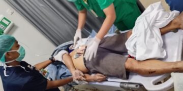 Akibat Sopir Mabuk, Pengendara Sepeda Motor Tewas Ditabrak di Jalan Bandara Lama Mimika