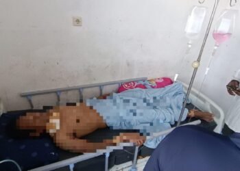 Warga Jadi Korban Penganiayaan Berat di Dekai, Satgas Kepolisian Operasi Damai Cartenz Kejar Pelaku